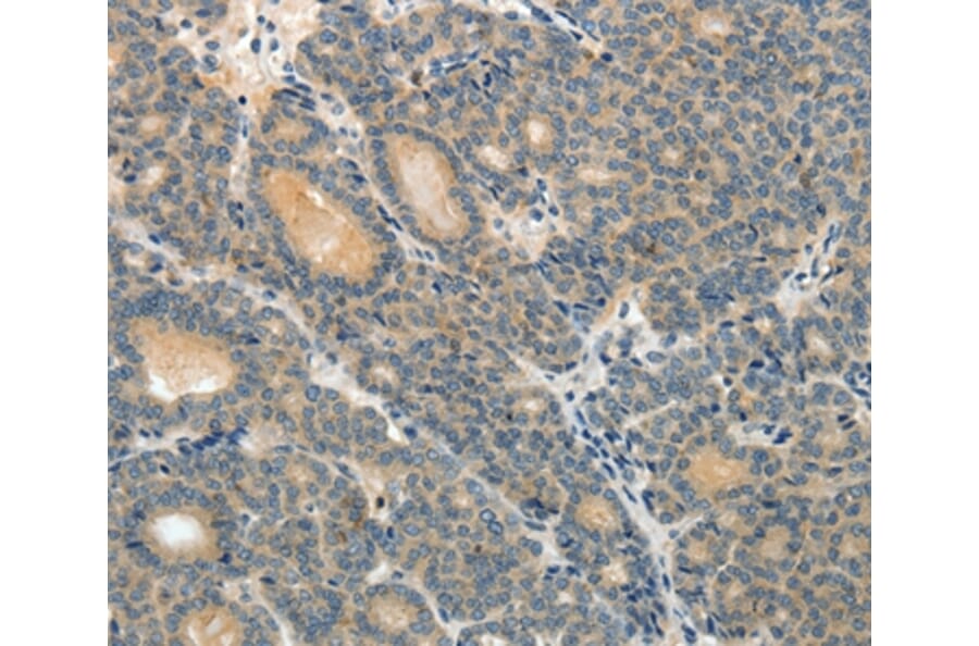 Immunohistochemistry - ABCC12 Antibody from Signalway Antibody (37072) - Antibodies.com