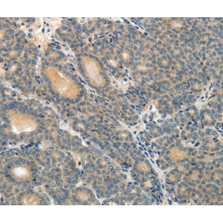 Immunohistochemistry - ABCC12 Antibody from Signalway Antibody (37072) - Antibodies.com