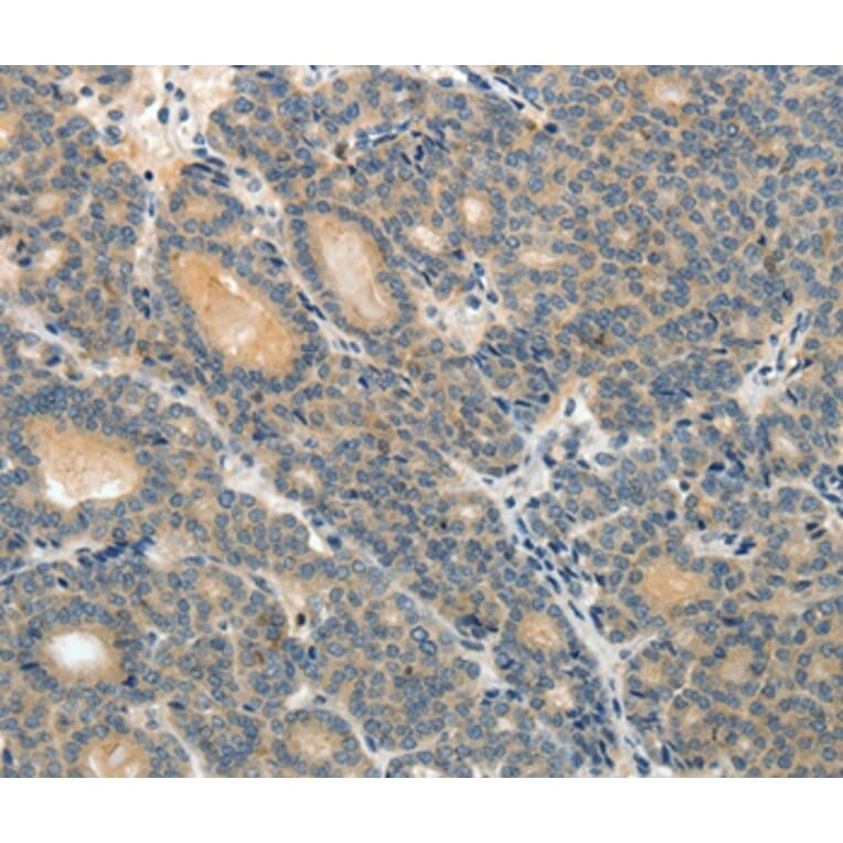 Immunohistochemistry - ABCC12 Antibody from Signalway Antibody (37072) - Antibodies.com