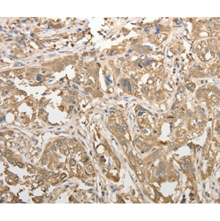 Immunohistochemistry - ADHFE1 Antibody from Signalway Antibody (37085) - Antibodies.com