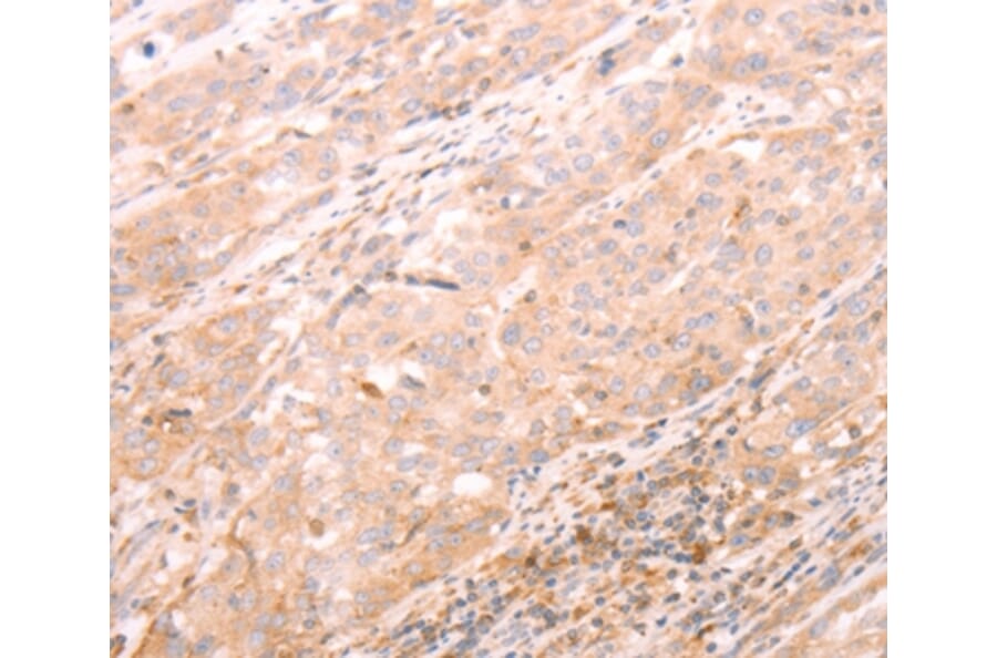 Immunohistochemistry - ALPPL2 Antibody from Signalway Antibody (37096) - Antibodies.com