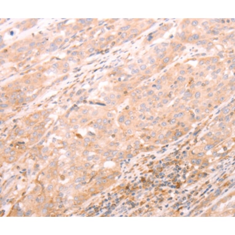 Immunohistochemistry - ALPPL2 Antibody from Signalway Antibody (37096) - Antibodies.com