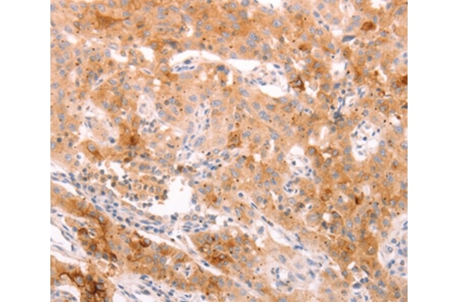 Immunohistochemistry - ALPPL2 Antibody from Signalway Antibody (37096) - Antibodies.com