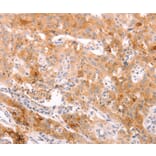 Immunohistochemistry - ALPPL2 Antibody from Signalway Antibody (37096) - Antibodies.com
