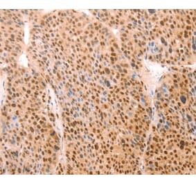 Immunohistochemistry - ALYREF Antibody from Signalway Antibody (37097) - Antibodies.com