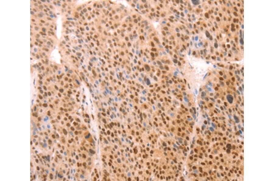 Immunohistochemistry - ALYREF Antibody from Signalway Antibody (37097) - Antibodies.com