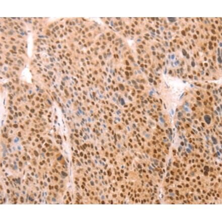 Immunohistochemistry - ALYREF Antibody from Signalway Antibody (37097) - Antibodies.com