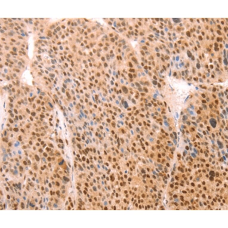 Immunohistochemistry - ALYREF Antibody from Signalway Antibody (37097) - Antibodies.com
