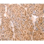 Immunohistochemistry - ALYREF Antibody from Signalway Antibody (37097) - Antibodies.com