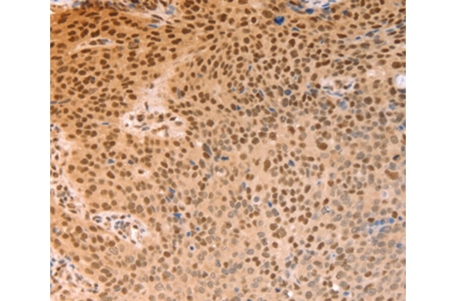 Immunohistochemistry - ALYREF Antibody from Signalway Antibody (37097) - Antibodies.com