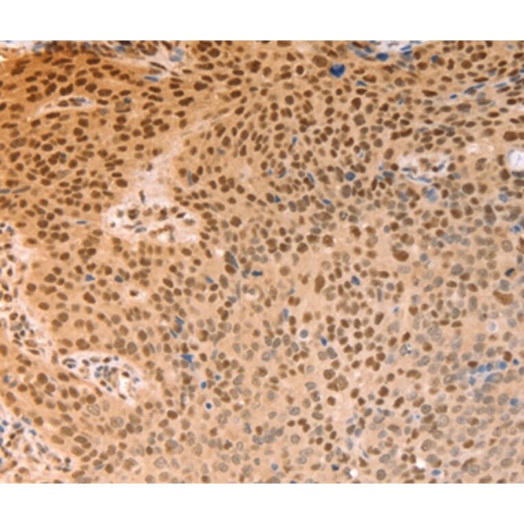 Immunohistochemistry - ALYREF Antibody from Signalway Antibody (37097) - Antibodies.com