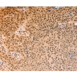 Immunohistochemistry - ALYREF Antibody from Signalway Antibody (37097) - Antibodies.com
