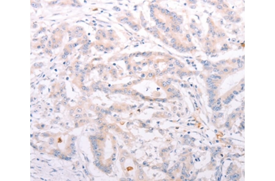 Immunohistochemistry - ANKRA2 Antibody from Signalway Antibody (37102) - Antibodies.com