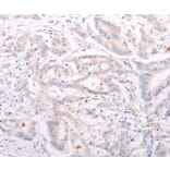 Immunohistochemistry - ANKRA2 Antibody from Signalway Antibody (37102) - Antibodies.com