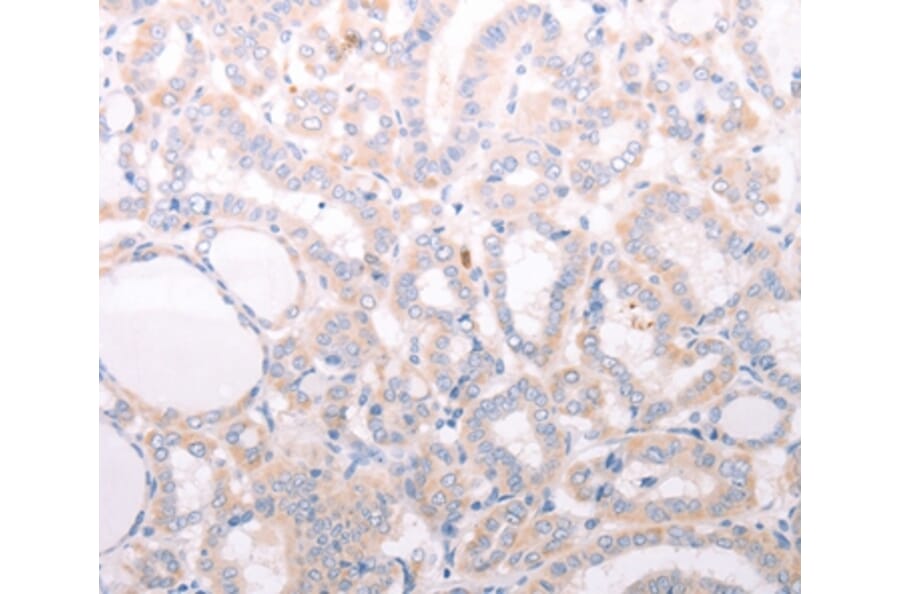 Immunohistochemistry - ANKRA2 Antibody from Signalway Antibody (37102) - Antibodies.com