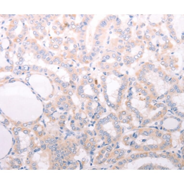 Immunohistochemistry - ANKRA2 Antibody from Signalway Antibody (37102) - Antibodies.com