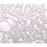 Immunohistochemistry - ANKRA2 Antibody from Signalway Antibody (37102) - Antibodies.com