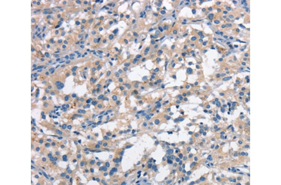 Immunohistochemistry - ANAPC1 Antibody from Signalway Antibody (37109) - Antibodies.com