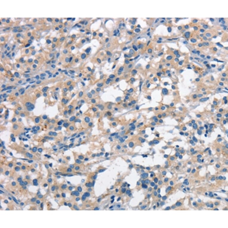 Immunohistochemistry - ANAPC1 Antibody from Signalway Antibody (37109) - Antibodies.com