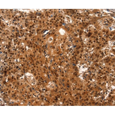 Immunohistochemistry - LIN28A Antibody from Signalway Antibody (37118) - Antibodies.com