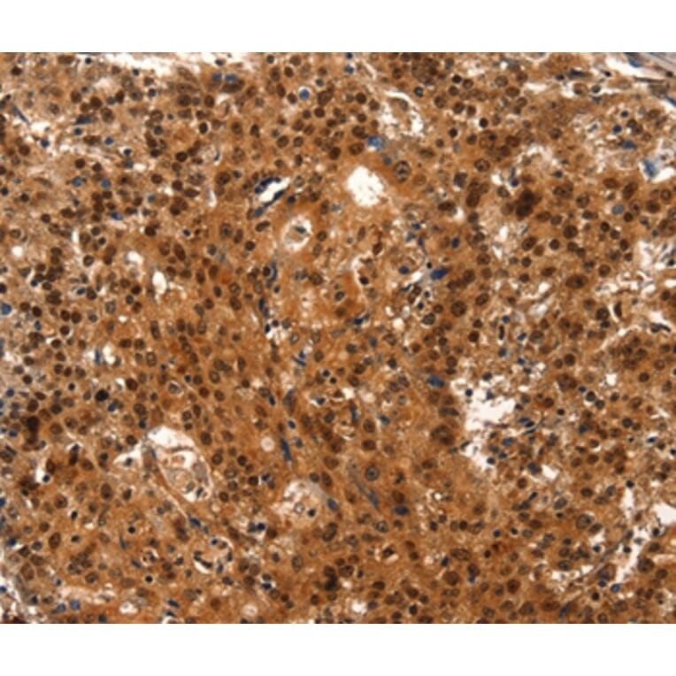 Immunohistochemistry - LIN28A Antibody from Signalway Antibody (37118) - Antibodies.com
