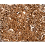 Immunohistochemistry - LIN28A Antibody from Signalway Antibody (37118) - Antibodies.com