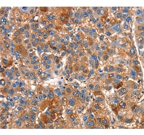 Immunohistochemistry - SMURF1 Antibody from Signalway Antibody (37123) - Antibodies.com