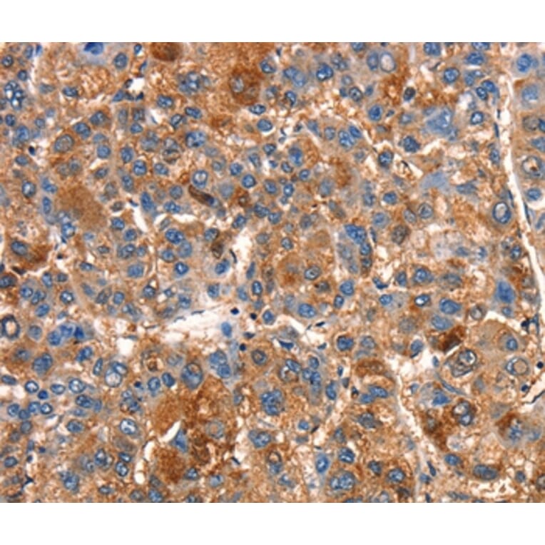 Immunohistochemistry - SMURF1 Antibody from Signalway Antibody (37123) - Antibodies.com