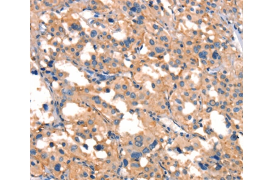 Immunohistochemistry - SMURF1 Antibody from Signalway Antibody (37123) - Antibodies.com