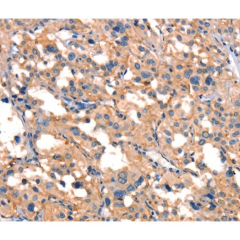 Immunohistochemistry - SMURF1 Antibody from Signalway Antibody (37123) - Antibodies.com