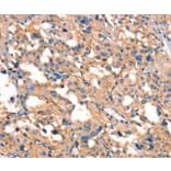 Immunohistochemistry - SMURF1 Antibody from Signalway Antibody (37123) - Antibodies.com