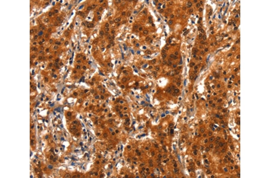 Immunohistochemistry - SMURF2 Antibody from Signalway Antibody (37124) - Antibodies.com