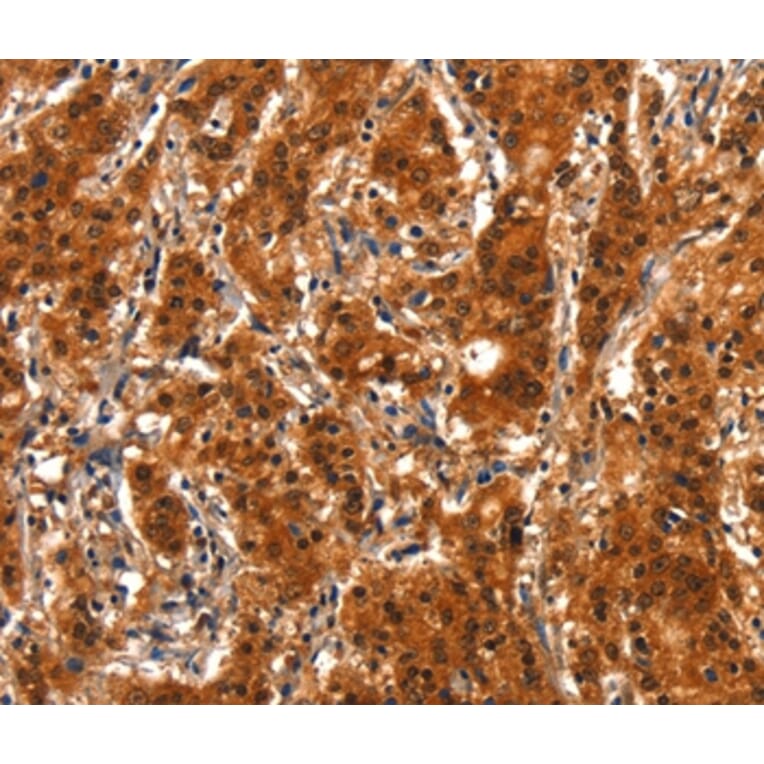 Immunohistochemistry - SMURF2 Antibody from Signalway Antibody (37124) - Antibodies.com