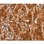 Immunohistochemistry - SMURF2 Antibody from Signalway Antibody (37124) - Antibodies.com