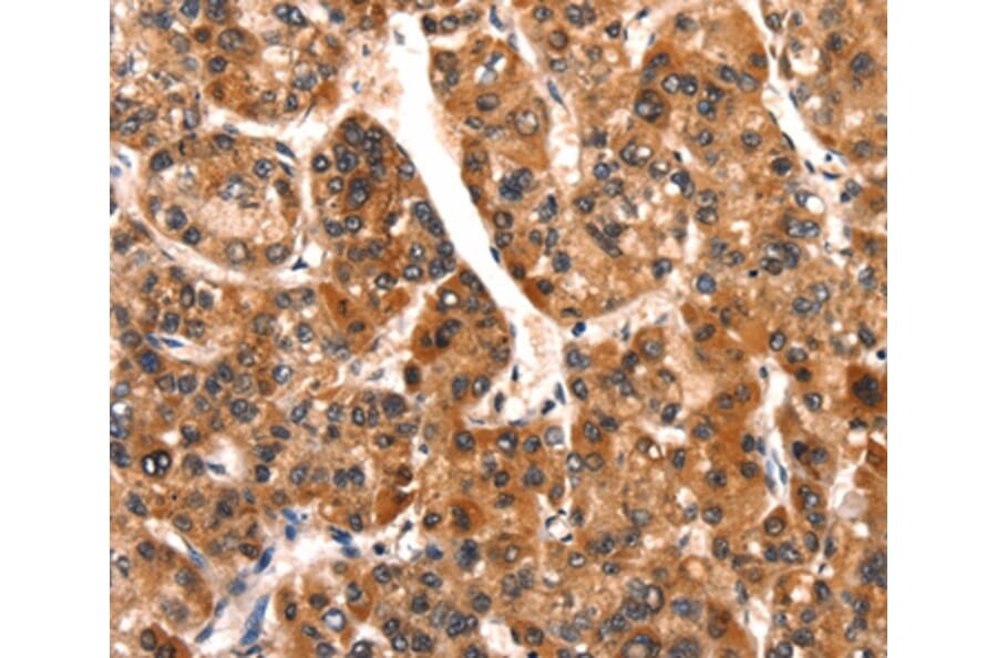 Immunohistochemistry - SMURF2 Antibody from Signalway Antibody (37124) - Antibodies.com