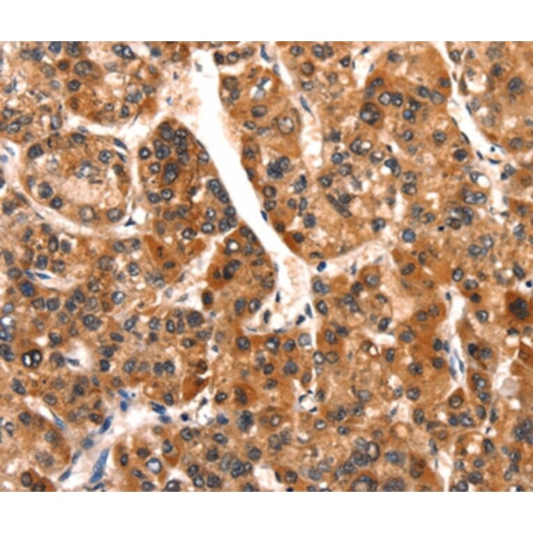 Immunohistochemistry - SMURF2 Antibody from Signalway Antibody (37124) - Antibodies.com