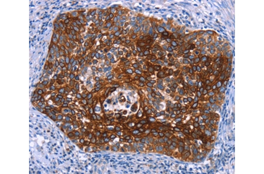 Immunohistochemistry - MAP3K2 Antibody from Signalway Antibody (37134) - Antibodies.com
