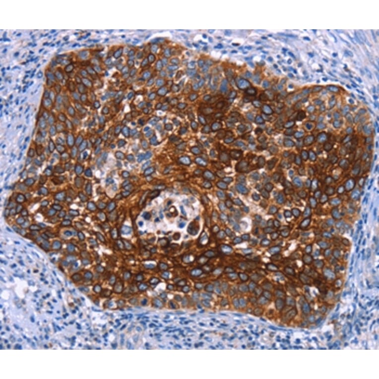 Immunohistochemistry - MAP3K2 Antibody from Signalway Antibody (37134) - Antibodies.com
