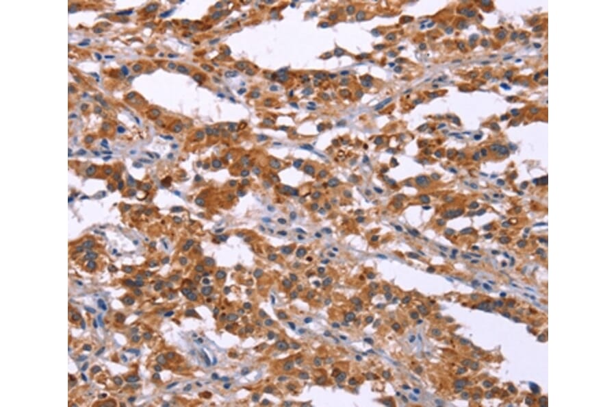 Immunohistochemistry - MAP3K2 Antibody from Signalway Antibody (37134) - Antibodies.com