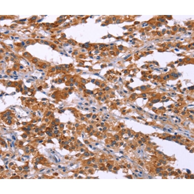 Immunohistochemistry - MAP3K2 Antibody from Signalway Antibody (37134) - Antibodies.com
