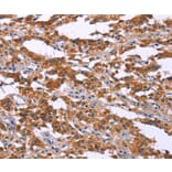 Immunohistochemistry - MAP3K2 Antibody from Signalway Antibody (37134) - Antibodies.com