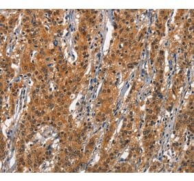 Immunohistochemistry - CD163 Antibody from Signalway Antibody (37157) - Antibodies.com