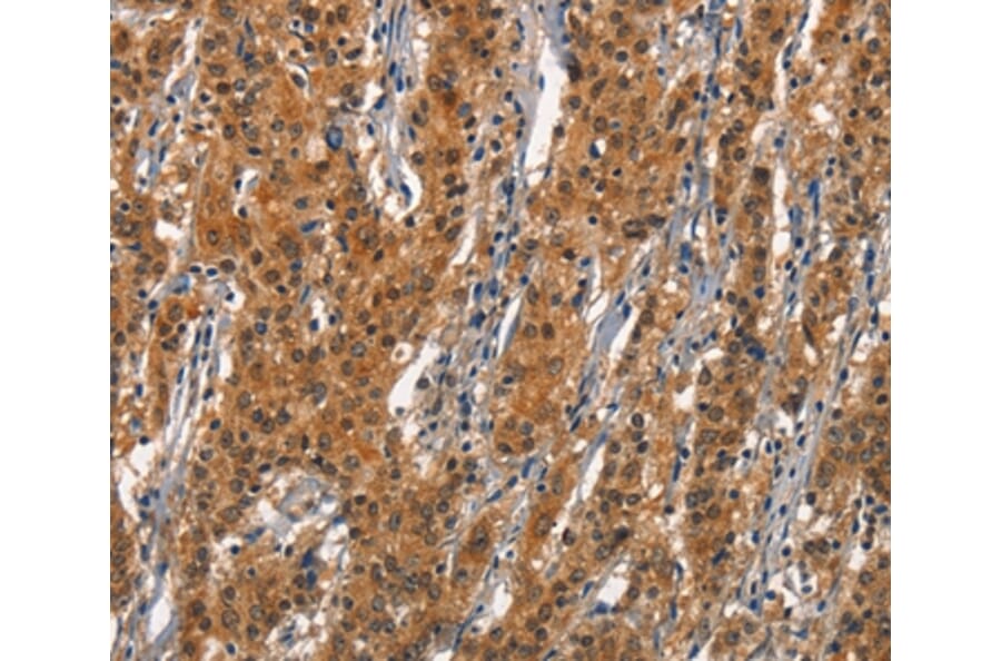 Immunohistochemistry - CD163 Antibody from Signalway Antibody (37157) - Antibodies.com