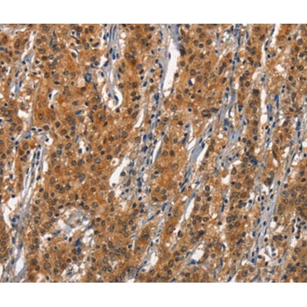Immunohistochemistry - CD163 Antibody from Signalway Antibody (37157) - Antibodies.com