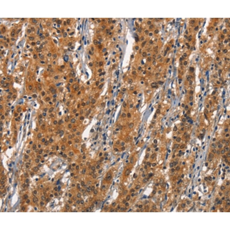 Immunohistochemistry - CD163 Antibody from Signalway Antibody (37157) - Antibodies.com
