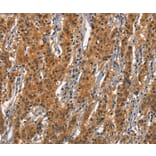 Immunohistochemistry - CD163 Antibody from Signalway Antibody (37157) - Antibodies.com