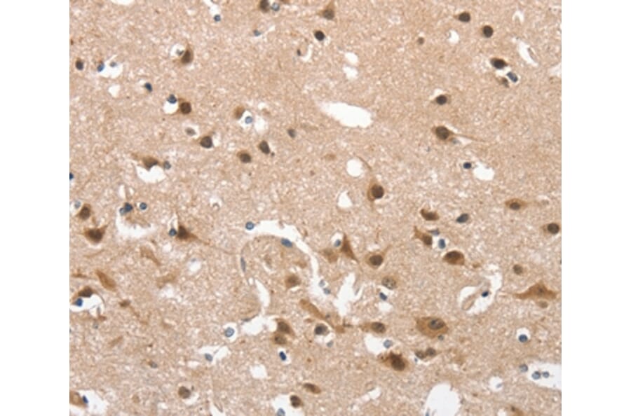 Immunohistochemistry - CD163 Antibody from Signalway Antibody (37157) - Antibodies.com