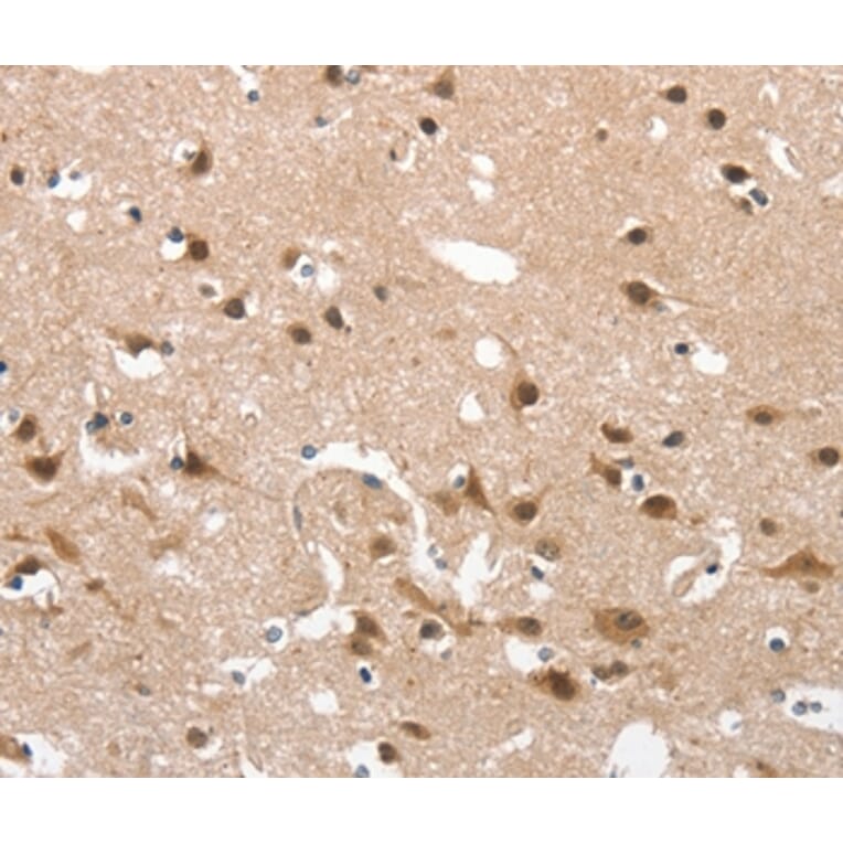 Immunohistochemistry - CD163 Antibody from Signalway Antibody (37157) - Antibodies.com