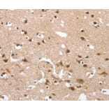 Immunohistochemistry - CD163 Antibody from Signalway Antibody (37157) - Antibodies.com