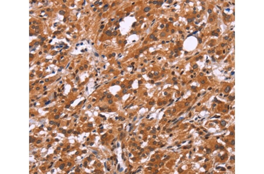 Immunohistochemistry - SLC8A2 Antibody from Signalway Antibody (37177) - Antibodies.com